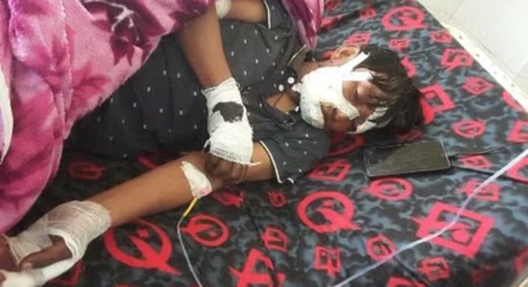 घर के आंगन में सो रहे ग्रामीणों पर गुलदार का हमला,तीन हुए घायल एक हायर सेंटर हुआ रेफर,स्थानीय ग्रामीणों में दहशत का माहौल।