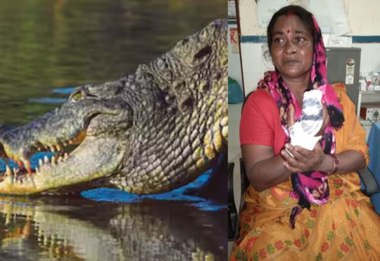 “गजब का साहस “खटीमा धान के खेत में निराई कर रही महिला को मगरमच्छ ने दबोचा:दरांती के दम पर मगरमच्छ के मुंह से बचकर आई शकुंतला